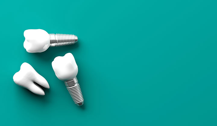 Three tooth for dental implants