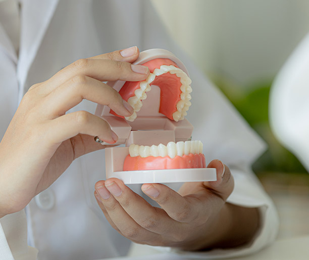  a hand of dentist holding a diagram of tooth, dental implants
