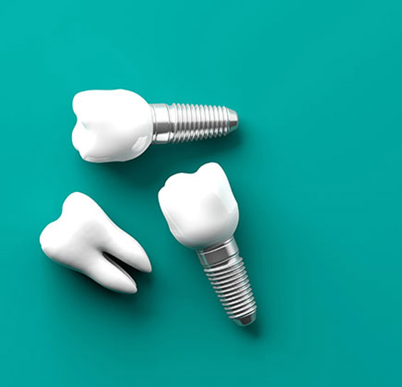 Dental Implants Success rates, a tooth for dental implants 