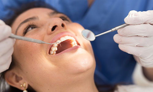 Dental Implants discount