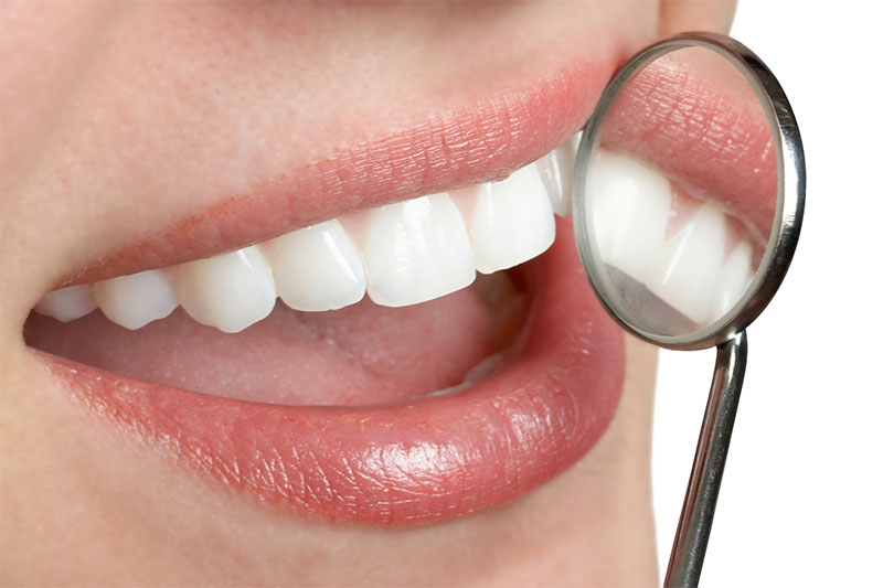 Intra-Oral Photography in Meridian
